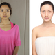 Image for article titled Intense Photos of Plastic Surgery Tranformations Going Viral in China